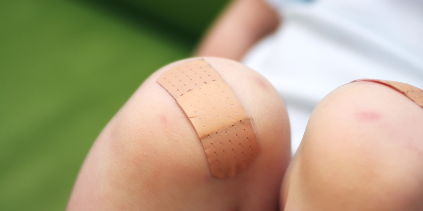 picture of child with injured knee